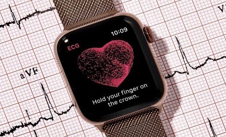 Tính năng đo điện tâm đồ trên Apple Watch sắp có tại Việt Nam